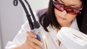 Epilation with alexandrite laser 