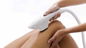 Epilation Elos