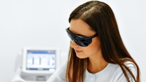 Laser epilation of the face