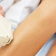 Photoepilation of the bikini zone
